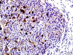 LRP1/CD91 Rabbit anti-Human, Polyclonal, Bioss 100 &mu;L; Unconjugated:Antibodies,