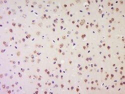 LRP1/CD91 Rabbit anti-Human, Polyclonal, Bioss 100 &mu;L; Unconjugated:Antibodies,