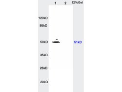 MCT4 Rabbit anti-Human, Polyclonal, Bioss 100 &mu;L; Unconjugated:Antibodies,
