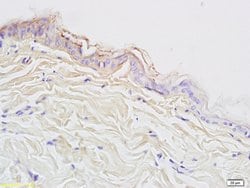 Cytokeratin 10 Rabbit anti-Human, Polyclonal, Bioss 100 &mu;L; Unconjugated:Antibodies,