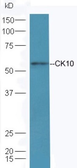 Cytokeratin 10 Rabbit anti-Human, Polyclonal, Bioss 100 &mu;L; Unconjugated:Antibodies,