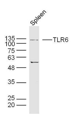 TLR6 Rabbit anti-Human, Polyclonal, Bioss 100 &mu;L; Unconjugated:Antibodies,