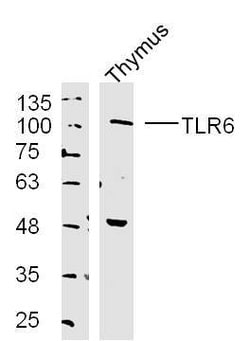 TLR6 Rabbit anti-Human, Polyclonal, Bioss 100 &mu;L; Unconjugated:Antibodies,