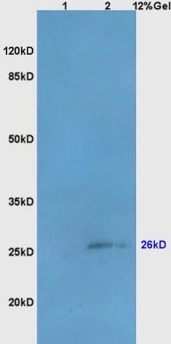 Bcl-10 Rabbit anti-Human, Polyclonal, Bioss 100 &mu;L; Unconjugated:Antibodies,