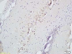 SLIT2/Slil3 Rabbit anti-Human, Polyclonal, Bioss 100 &mu;L; Unconjugated:Antibodies,