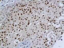 DBC1/deleted in bladder cancer 1 Rabbit anti-Human, Polyclonal, Bioss 100