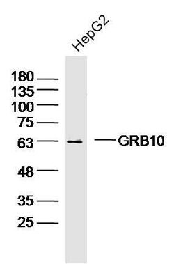GRB10/14 Rabbit anti-Human Mouse Rat, Polyclonal, Bioss 100 &mu;L; Unconjugated:Antibodies,