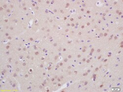 Prox1 Rabbit anti-Human, Polyclonal, Bioss 100 &mu;L; Unconjugated:Antibodies,