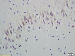 RGS5 Rabbit anti-Human, Polyclonal, Bioss 100 &mu;L; Unconjugated:Antibodies,