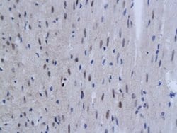 TNFAIP3 Rabbit anti-Human, Polyclonal, Bioss 100 &mu;L; Unconjugated:Antibodies,