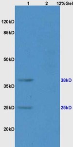 CD161 Rabbit anti-Human, Polyclonal, Bioss 100 μL; Unconjugated ...