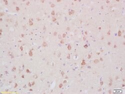 MARCKS Rabbit anti-Human, Polyclonal, Bioss 100 &mu;L; Unconjugated:Antibodies,