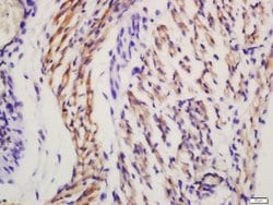 Frizzled 5/8 Rabbit anti-Human, Polyclonal, Bioss 100 &mu;L; Unconjugated:Antibodies,