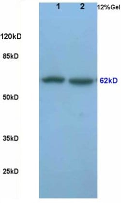 Frizzled 5/8 Rabbit anti-Human, Polyclonal, Bioss 100 &mu;L; Unconjugated:Antibodies,