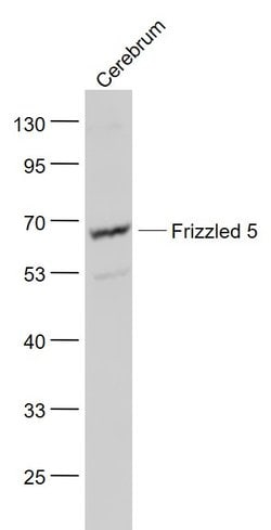 Frizzled 5/8 Rabbit anti-Human, Polyclonal, Bioss 100 &mu;L; Unconjugated:Antibodies,