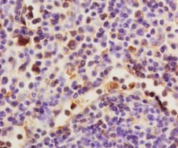 HAS1 Rabbit anti-Human, Polyclonal, Bioss 100 &mu;L; Unconjugated:Antibodies,