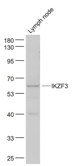 IKZF3 Rabbit anti-Human, Polyclonal, Bioss 100 &mu;L; Unconjugated:Antibodies,