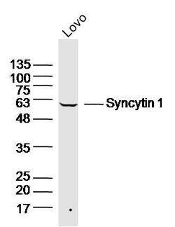 Syncytin 1 Rabbit anti-Human, Polyclonal, Bioss 100 &mu;L; Unconjugated:Antibodies,