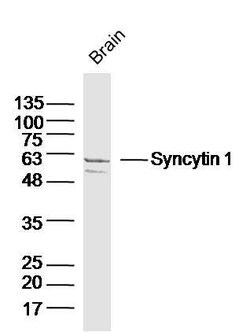 Syncytin 1 Rabbit anti-Human, Polyclonal, Bioss 100 &mu;L; Unconjugated:Antibodies,