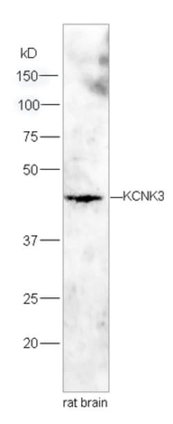 KCNK3 Rabbit anti-Human, Polyclonal, Bioss 100 &mu;L; Unconjugated:Antibodies,