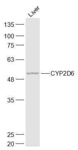 CYP2D6 Rabbit anti-Human, Polyclonal, Bioss 100 &mu;L; Unconjugated:Antibodies,