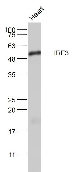 IRF3 Rabbit anti-Human, Polyclonal, Bioss 100 &mu;L; Unconjugated:Antibodies,
