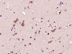 Phospho-ASK1 (Ser966) Rabbit anti-Human, Polyclonal, Bioss 100 &mu;L; Unconjugated:Antibodies,