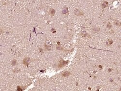 Phospho-BAD (Ser75) Rabbit anti-Human, Polyclonal, Bioss 100 &mu;L; Unconjugated:Antibodies,
