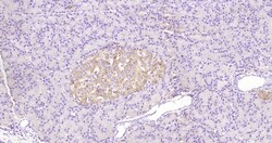 Phospho-Bax (Ser184) Polyclonal Antibody, Bioss 100 &mu;L | Buy Online | Bioss | Fisher Scientific