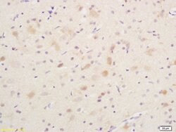 Phospho-B-Raf (Ser365) Rabbit anti-Human, Polyclonal, Bioss 100 &mu;L;