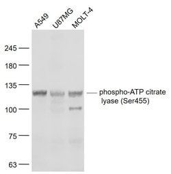 Phospho-ATP citrate lyase (Ser455) Rabbit anti-Human, Polyclonal, Bioss