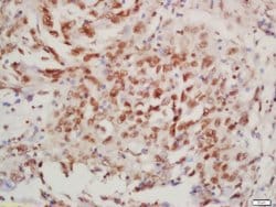 Phospho-BTK (Tyr223) Rabbit anti-Human, Polyclonal, Bioss 100 &mu;L; Unconjugated:Antibodies,