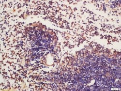 Phospho-BTK (Tyr223) Rabbit anti-Human, Polyclonal, Bioss 100 &mu;L; Unconjugated:Antibodies,