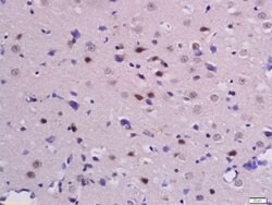 Phospho-beta Catenin (Ser33, Ser37) Rabbit anti-Human Mouse Rat, Polyclonal,