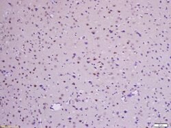 Phospho-beta Catenin (Ser33, Ser37) Rabbit anti-Human Mouse Rat, Polyclonal,