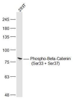 Phospho-beta Catenin (Ser33, Ser37) Rabbit anti-Human Mouse Rat, Polyclonal,