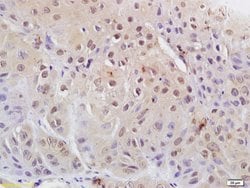 Phospho-CDK1 (Tyr15) Rabbit anti-Human, Polyclonal, Bioss 100 &mu;L; Unconjugated:Antibodies,