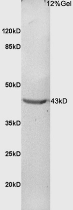Phospho-CDK9 (Thr186) Rabbit anti-Human, Polyclonal, Bioss 100 &mu;L | Buy Online | Bioss | Fisher Scientific