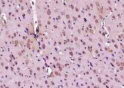 Phospho-Doublecortin (Ser47) Rabbit anti-Human, Polyclonal, Bioss 100 &mu;L;