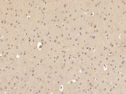 Phospho-FoxO3a (Ser318, Ser321) Rabbit anti-Human Mouse Rat, Polyclonal,
