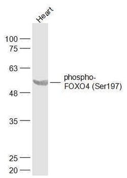 Phospho-FOXO4/FOXO1 (Ser197, Ser256) Rabbit anti-Human, Polyclonal, Bioss