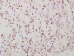 Phospho-FRA1 (Ser265) Rabbit anti-Human, Polyclonal, Bioss 100 &mu;L; Unconjugated:Antibodies,