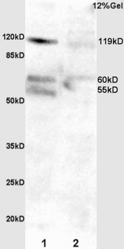 Phospho-FAK (Tyr397) Rabbit anti-Human, Polyclonal, Bioss 100 &mu;L | Buy Online | Bioss | Fisher Scientific