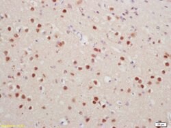 Phospho-Histone H1.4 (Thr18) Rabbit anti-Human, Polyclonal, Bioss 100 &mu;L;