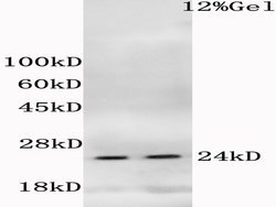 Phospho-Histone H1.4 (Thr18) Rabbit anti-Human, Polyclonal, Bioss 100 &mu;L;
