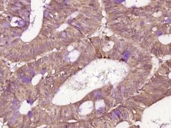 Phospho-IRAK1 (Thr209) Rabbit anti-Human, Polyclonal, Bioss 100 &mu;L;