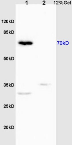 Phospho-IRAK1 (Thr209) Rabbit anti-Human, Polyclonal, Bioss 100 &mu;L;