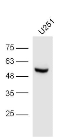 Phospho-IRF3 (Ser396) Rabbit anti-Human, Polyclonal, Bioss 100 &mu;L; Unconjugated:Antibodies,