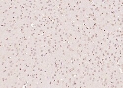 Phospho-HER4 (Tyr1284) Rabbit anti-Human, Polyclonal, Bioss 100 &mu;L;