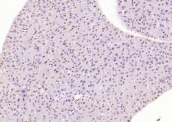 Phospho-HER4 (Tyr1284) Rabbit anti-Human, Polyclonal, Bioss 100 &mu;L;